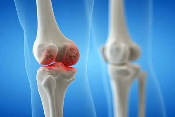 Bone & Joint infection Treatment in Coimbatore- Dr. A. Murali